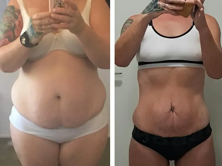 Martine voor en na haar begeleiding bij FastFit Mechelen