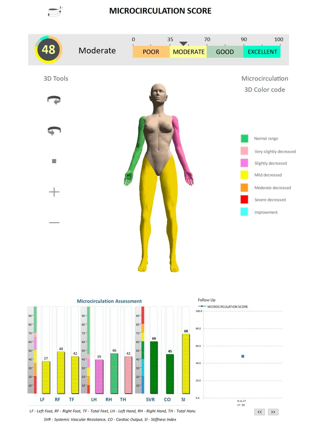 Aanvullende weergave van de Body Reset Analyse