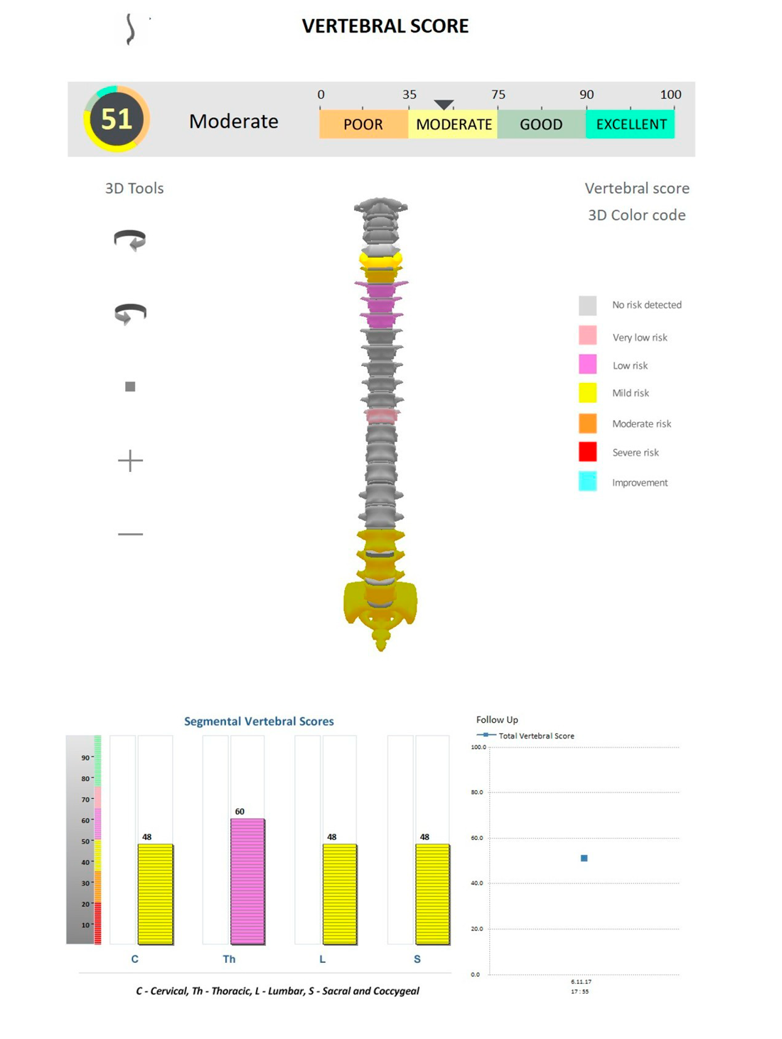 Wervelkolom en houding analyse