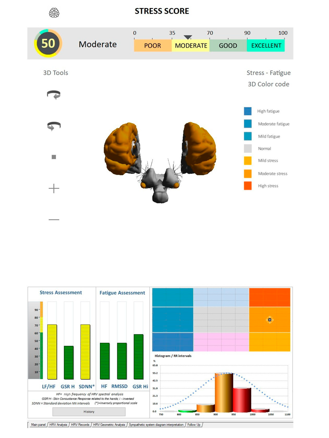 Stress en vermoeidheid score – Body Reset Analyse personal trainer Mechelen